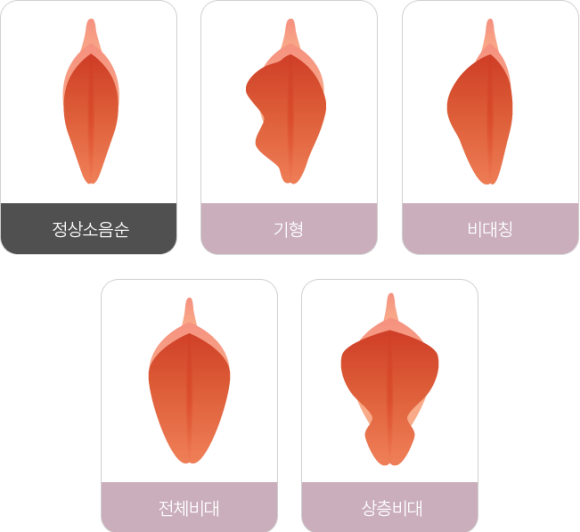 �������� �پ��� ����