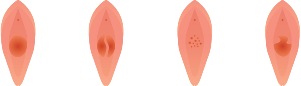 ´Ù¾çÇÑ Ã³³à¸·ÀÇ ÇüÅÂ