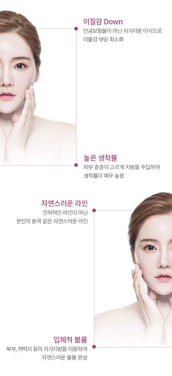 �������̽� ������ Ư¡