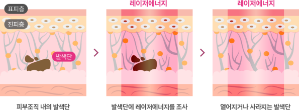 ��������� ����