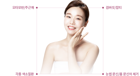 Nd:YAG ������ �����ȯ