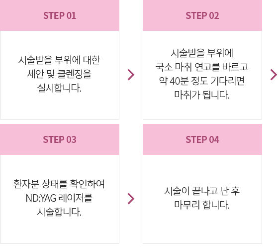 Nd:YAG ������ �ü�����