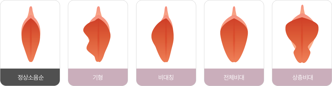 �������� �پ��� ����