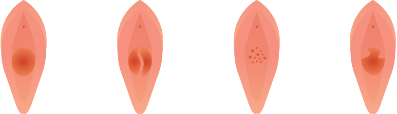 �پ��� ó�ื�� ����