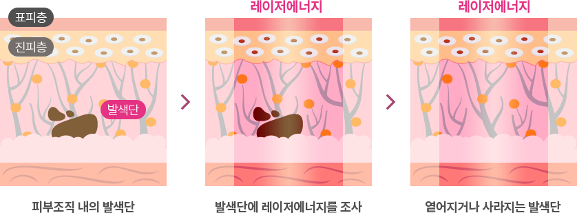 ��������� ����